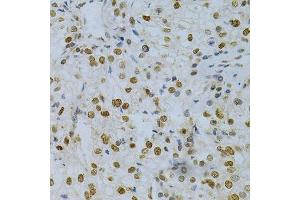 Immunohistochemistry (Paraffin-embedded Sections) (IHC (p)) image for anti-ELAV (Embryonic Lethal, Abnormal Vision, Drosophila)-Like 1 (Hu Antigen R) (ELAVL1) (AA 1-326) antibody (ABIN3022231)