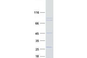 Validation with Western Blot