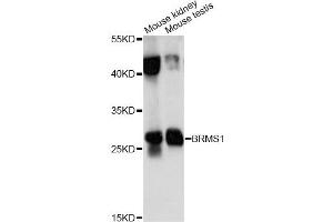 Western blot analysis of extracts of various cell lines, using BRMS1 antibody (ABIN6290118) at 1:1000 dilution. (BRMS1 antibody)
