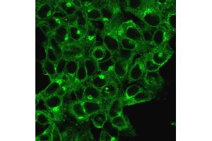 Immunofluorescence (IF) image for anti-beta-2-Microglobulin (B2M) antibody (ABIN6940411)