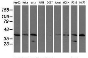 Image no. 4 for anti-Ubiquitin-Conjugating Enzyme E2, J1, U (UBE2J1) antibody (ABIN1501637)