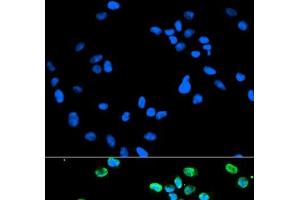 Immunofluorescence analysis of HeLa cells using IRF5 Polyclonal Antibody (IRF5 antibody)