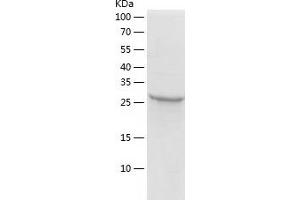 Western Blotting (WB) image for Zinc Finger Protein 518A (ZNF518A) (AA 495-780) protein (His tag) (ABIN7287596) (ZNF518A Protein (AA 495-780) (His tag))