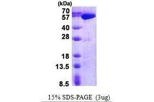 Figure annotation denotes ug of protein loaded and % gel used. (USP14 Protein)