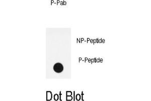 Dot Blot (DB) image for anti-LPR1 (pSer4520) antibody (ABIN3001761) (LPR1 (pSer4520) antibody)