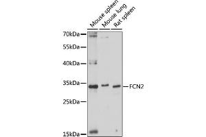 Western blot analysis of extracts of various cell lines, using FCN2 antibody (ABIN7267201) at 1:1000 dilution. (Ficolin 2 antibody  (AA 230-290))