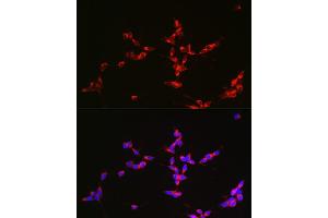 Immunofluorescence analysis of SH-SY5Y cells using Glutaminase (GLS) antibody (ABIN1680034, ABIN3018235, ABIN3018236 and ABIN6220412) at dilution of 1:150. (Glutaminase antibody  (AA 610-669))