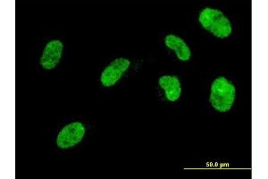 Immunofluorescence of monoclonal antibody to NHLH2 on HeLa cell.