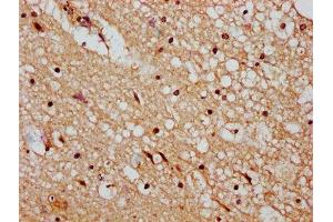 IHC image of ABIN7150197 diluted at 1:400 and staining in paraffin-embedded human brain tissue performed on a Leica BondTM system. (DMAP1 antibody  (AA 250-300))