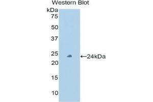 Detection of Recombinant PXDN, Human using Polyclonal Antibody to Peroxidasin Homolog (PXDN) (Peroxidasin antibody  (AA 76-260))