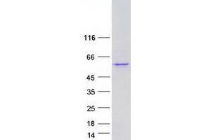Western Blotting (WB) image for Tumor Protein P73 (TP73) (Transcript Variant 4) protein (Myc-DYKDDDDK Tag) (ABIN2734637)