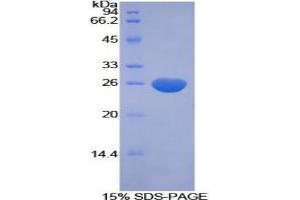SDS-PAGE analysis of Human CFC1 Protein.