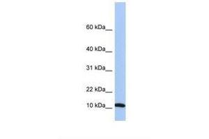 Image no. 1 for anti-Finkel-Biskis-Reilly Murine Sarcoma Virus (FBR-MuSV) Ubiquitously Expressed (FAU) (C-Term) antibody (ABIN6749758) (FAU antibody  (C-Term))