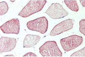 Detection of MERTK in Human Skeletal Muscle Tissue using Polyclonal Antibody to C-Mer Proto Oncogene Tyrosine Kinase (MERTK) (MERTK antibody  (AA 587-858))