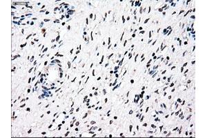 Immunohistochemical staining of paraffin-embedded Ovary tissue using anti-NRBP1mouse monoclonal antibody. (NRBP1 antibody)