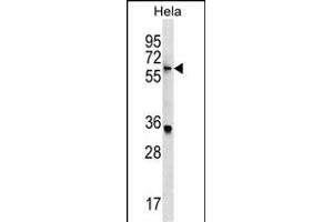 KLH22 Antibody (C-term) (ABIN1537487 and ABIN2849661) western blot analysis in Hela cell line lysates (35 μg/lane). (KLHL22 antibody  (C-Term))