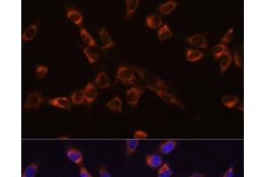 Immunofluorescence analysis of NIH-3T3 cells using STK3 Polyclonal Antibody at dilution of 1:100 (40x lens). (STK3 antibody)