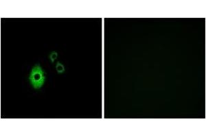 Immunofluorescence analysis of A549 cells, using KCNJ5 Antibody. (KCNJ5 antibody  (AA 370-419))