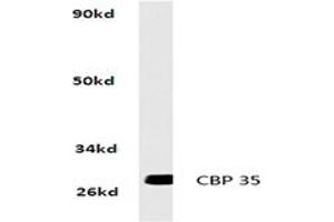 Image no. 2 for anti-Galectin 3 (LGALS3) antibody (ABIN265430) (Galectin 3 antibody)
