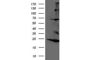HEK293T cells were transfected with the pCMV6-ENTRY control (Left lane) or pCMV6-ENTRY RNF144B (Right lane) cDNA for 48 hrs and lysed. (RNF144B antibody  (AA 1-256))