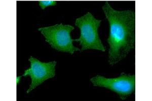 ICC/IF analysis of SBDS in HeLa cells line, stained with DAPI (Blue) for nucleus staining and monoclonal anti-human SBDS antibody (1:100) with goat anti-mouse IgG-Alexa fluor 488 conjugate (Green). (SBDS antibody  (AA 1-250))