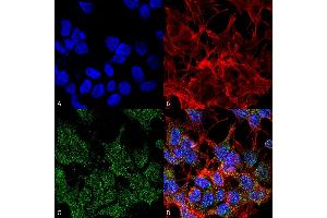 Immunocytochemistry/Immunofluorescence analysis using Mouse Anti-VGLUT2 Monoclonal Antibody, Clone S29-29 . (Solute Carrier Family 17 (Vesicular Glutamate Transporter), Member 6 (SLC17A6) (AA 501-582) antibody (Atto 594))