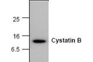Western Blotting (WB) image for anti-Cystatin B (Stefin B) (CSTB) antibody (ABIN126940) (CSTB antibody)