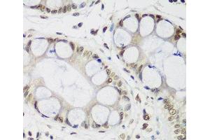 Immunohistochemistry of paraffin-embedded Human gastric using CBX3 Polyclonal Antibody at dilution of 1:200 (40x lens). (CBX3 antibody)