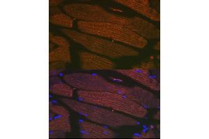 Immunofluorescence analysis of mouse bone marrow cells using SERC/ Rabbit mAb (9639) at dilution of 1:100 (40x lens). (ATP2A1/SERCA1 antibody)