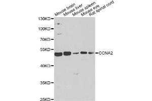 Western blot analysis of extracts of various cell lines, using CCNA2 antibody (ABIN5995369) at 1/1000 dilution. (Cyclin A antibody)