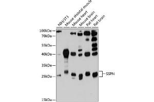 Western blot analysis of extracts of various cell lines, using SSPN antibody (ABIN6132896, ABIN6148488, ABIN6148489 and ABIN6215784) at 1:3000 dilution. (SSPN antibody  (AA 1-60))