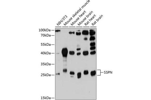 SSPN anticorps  (AA 1-60)