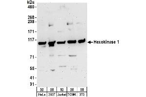 Western Blotting (WB) image for anti-Hexokinase 1 (HK1) (AA 325-375) antibody (ABIN7452942)