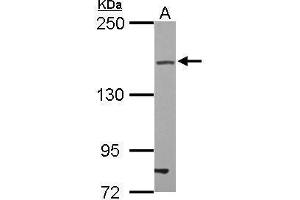 WB Image Sample (30 ug of whole cell lysate) A: U87-MG 5% SDS PAGE antibody diluted at 1:500 (TJP2 antibody)