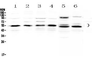 Western blot analysis of RXRA using anti-RXRA antibody . (Retinoid X Receptor alpha antibody  (AA 226-462))