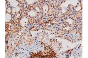 ABIN6267487 at 1/200 staining Mouse lung tissue sections by IHC-P. (alpha Adducin antibody  (pSer726))