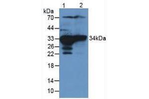 Western blot analysis of (1) Rat Liver Tissue and (2) Rat Kidney Tissue. (SULT1A1 antibody  (AA 3-291))