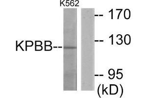 Western Blotting (WB) image for anti-Phosphorylase Kinase, beta (PHKB) (Internal Region) antibody (ABIN1849876)