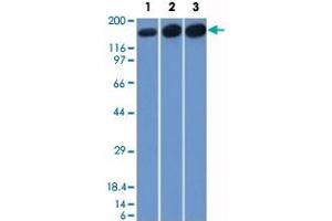 Western Blot analysis of Lane 1: HepG2, Lane 2: HeLa and Lane 3: 3T3 cell lysates with TOP2A monoclonal antibody, clone TOP2A/1361 .
