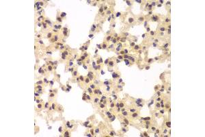 Immunohistochemistry of paraffin-embedded rat lung using CSNK2A2 antibody (ABIN6290214) at dilution of 1:100 (40x lens).