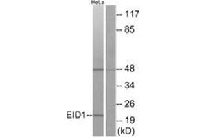 Western blot analysis of extracts from HeLa cells, using EID1 Antibody. (EID1 antibody  (AA 71-120))