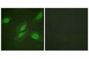 Immunofluorescence analysis of HeLa cells, using Akt (Ab-326) antibody. (AKT1 antibody  (Tyr326))