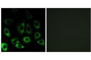Immunofluorescence analysis of A549 cells, using MBTPS2 antibody.