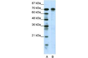 Human Jurkat; WB Suggested Anti-HIC1 Antibody Titration: 0. (HIC1 antibody  (N-Term))