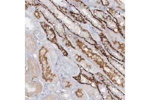 Immunohistochemical staining of human kidney with ATP11A polyclonal antibody  shows strong cytoplasmic and membranous positivity in distal tubules.