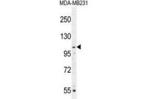 Western blot analysis in MDA-MB231 cell line lysates (35ug/lane) using MYSM1 Antibody (N-term).