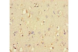 Immunohistochemistry of paraffin-embedded human brain tissue using ABIN7150193 at dilution of 1:100 (LIG3 antibody  (AA 809-928))