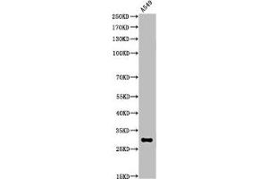 Western Blot analysis of A549 cells using Acetyl-ATF-5 (K29) Polyclonal Antibody (ATF5 antibody  (acLys29))