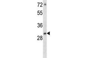 ATF5 antibody western blot analysis in MCF-7 lysate (ATF5 antibody  (AA 188-216))