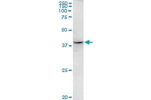 RHOXF2 monoclonal antibody (M07), clone 3C4. (RHOXF2 antibody  (AA 1-288))